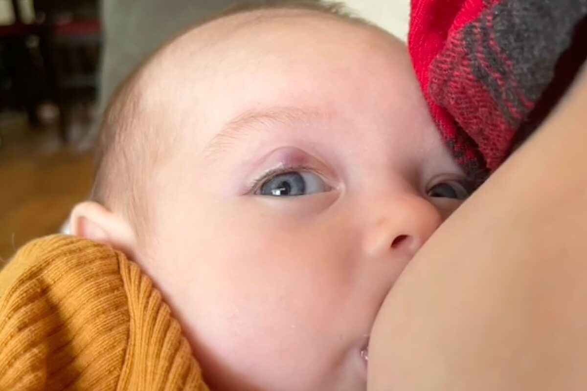 belekan pada bayi